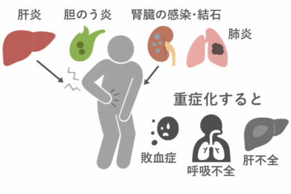 右脇腹の痛み・重さは危険？受診の目安と注意すべき症状