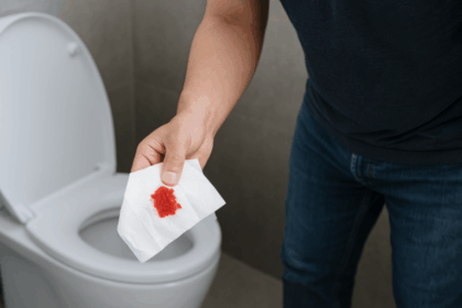 トイレットペーパーに血がつく？出血の原因と受診の目安