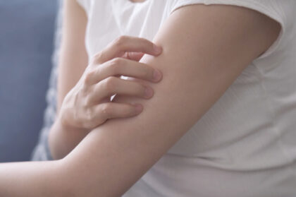 皮膚科に行っても治らないかゆみにお悩みの方へ